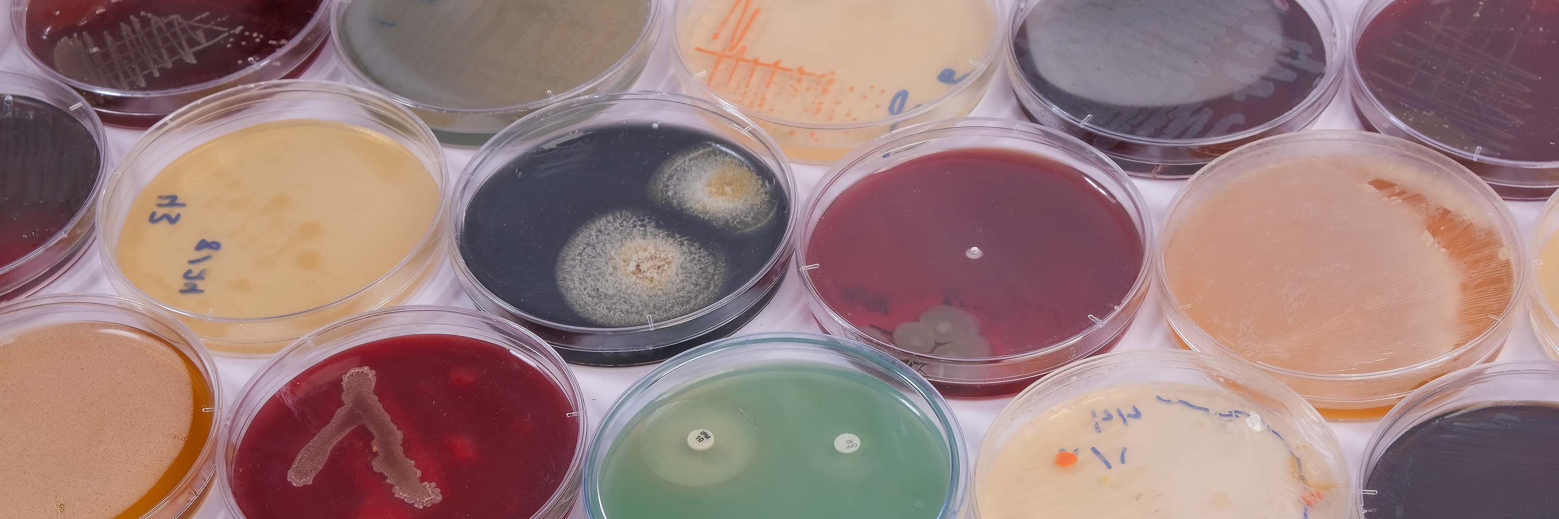 Collection of culture plates containing growth of microorganisms on different agar media.