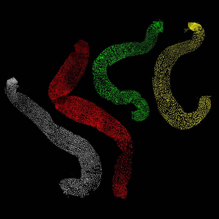 Four intestinal samples from fruit flies. The normal-sized intestine appears in white. A larger-than-average intestine with a mutated FMR1 gene appears in red. A smaller-than-average intestine with a mutated LIN-28 gene appears in green. A sample from a fly with both mutations appears in yellow.