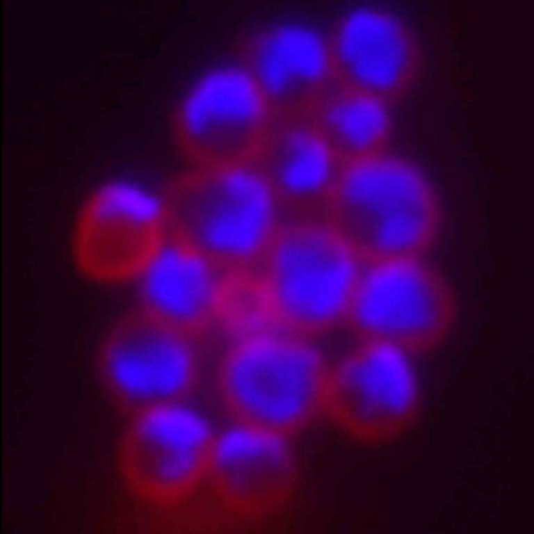 Sulfolobus, a genus of archaea that prefers high temperatures. Each cell is outlined in red. The DNA is stained blue. Image courtesy Stephen Bell, Indiana University