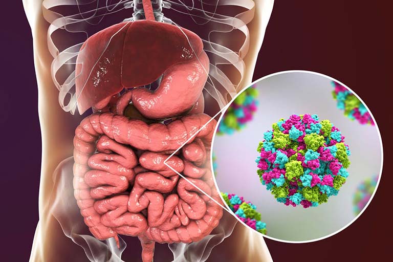 Image of the human digestive system. An arrow points to the intestines from a drawing of the norovirus, indicating that the norovirus infects the small intestines.