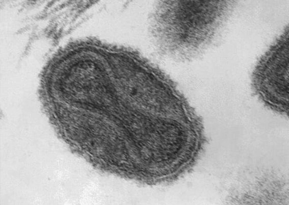 Under a magnification of 370,000X, the dumbbell-shaped viral core of the smallpox virus is visible.