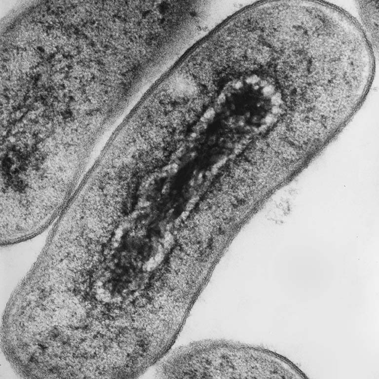 Cross section of Escherichia coli bacteria under transmission electron microscopy. Adobe Stock photo #196637990