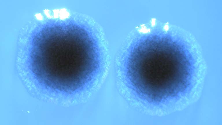 Two Xenorhabdus bovienii bacteria.