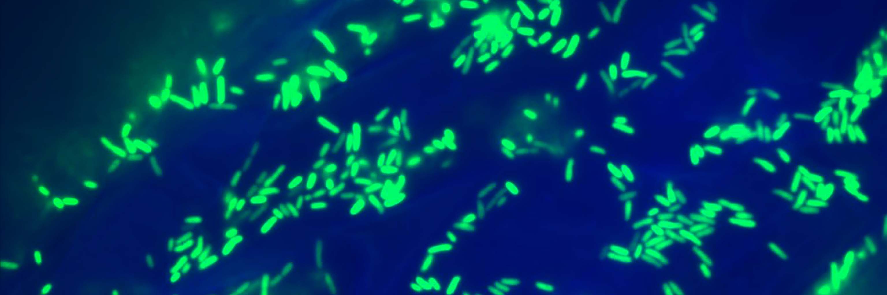 Fluorescence micrograph of Agrobacterium tumefaciens, a plant pathogenic bacterial species, on the root surface of the model plant Arabidopsis thaliana (mouse-ear cress). Each of the rod-shaped cells is about 2 microns in length. The plant root autofluoresces, but the bacteria are expressing green fluorescent protein (GFP) originally from jellyfish.