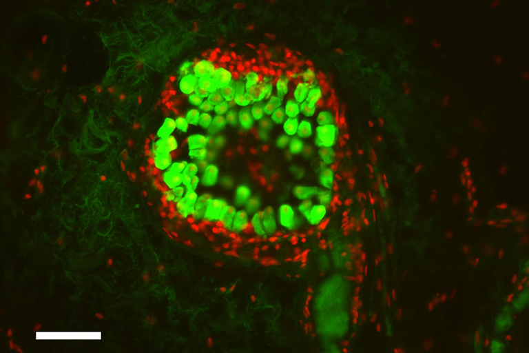 From G. Troy Smith Lab, IU Biology: Immunohistochemistry showing expression of the voltage-gated potassium channel (Kv1.2, green) in the electroreceptor cells of a tuberous organ in the skin of a brown ghost knifefish (Apteronotus leptorhynchus).  Voltage-gated sodium, calcium, and potassium channels in these cells allow them to be tuned to optimally detect the high frequency electrical signals produced by this species’ electric organ.