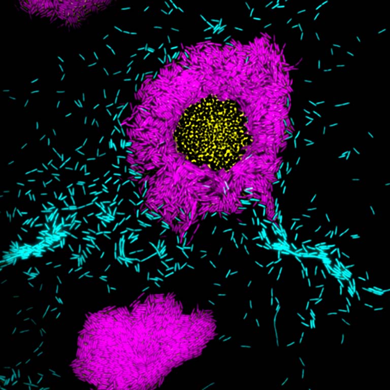 Pseudomonas aeruginosa cells labeled magenta are capable of sensing and attacking Staphylococcus aureus, labeled yellow, while P. aeruginosa cells in cyan have been genetically modified to be blind to interspecies signals.